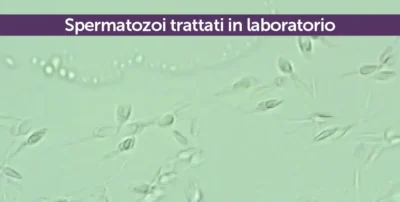 Spermatozoi trattati in laboratorio