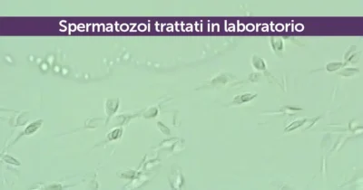 Spermatozoi trattati in laboratorio