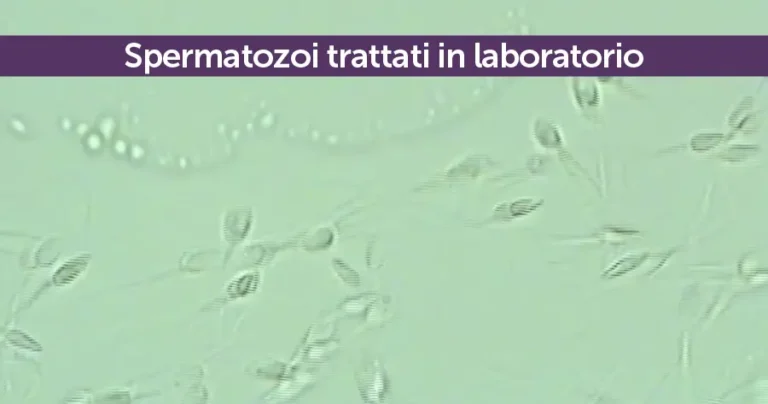 spermatozoi trattati in laboratorio megaride napoli