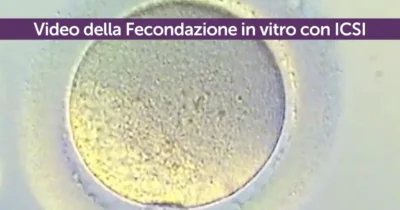 Video fecondazione in vitro