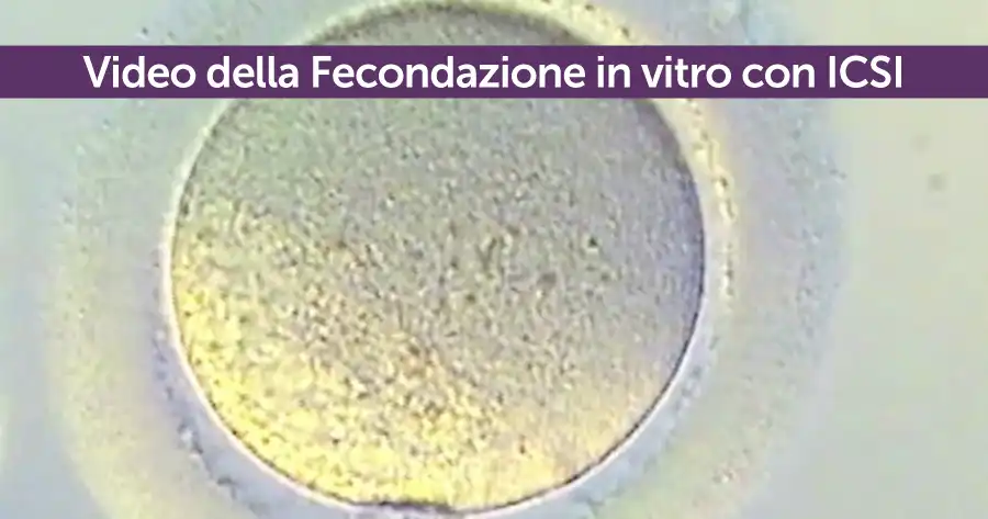video-della-fecondazione-in-vitro-con-icsi-megaride-pma-napoli