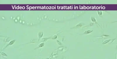 Video spermatozoi trattati in laboratorio