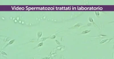 Video spermatozoi trattati in laboratorio